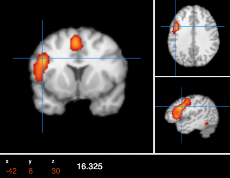 Brain activity during speech behavior